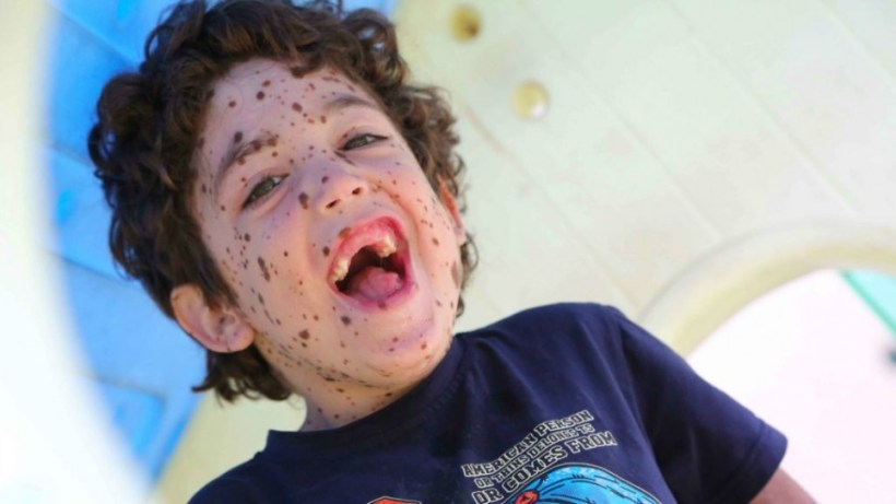 Positive Exposure Photo by Rick Guidotti