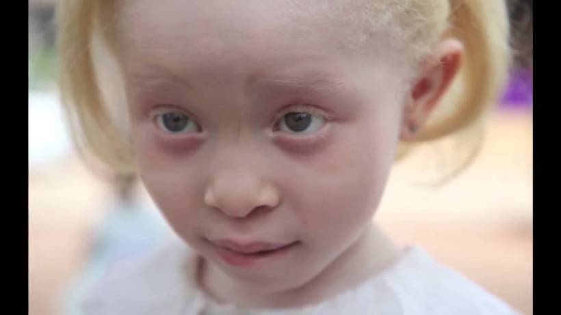 Positive Exposure Photo by Rick Guidotti