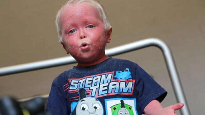 Positive Exposure Photo by Rick Guidotti