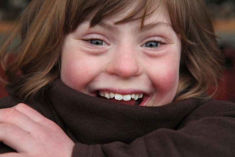 Positive Exposure Photo by Rick Guidotti