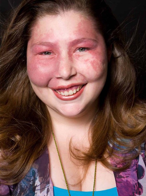 Positive Exposure Photo by Rick Guidotti