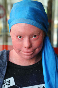 Positive Exposure Photo by Rick Guidotti