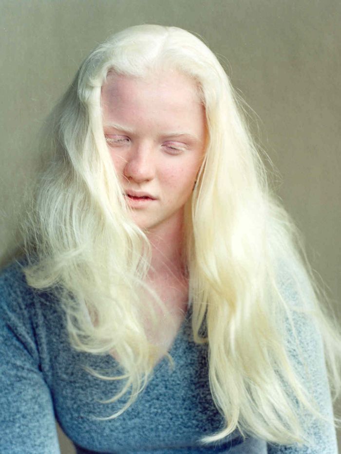 Positive Exposure Photo by Rick Guidotti