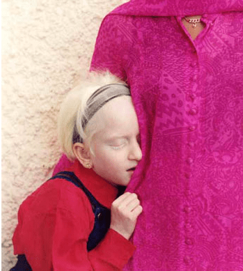 Positive Exposure Photo by Rick Guidotti