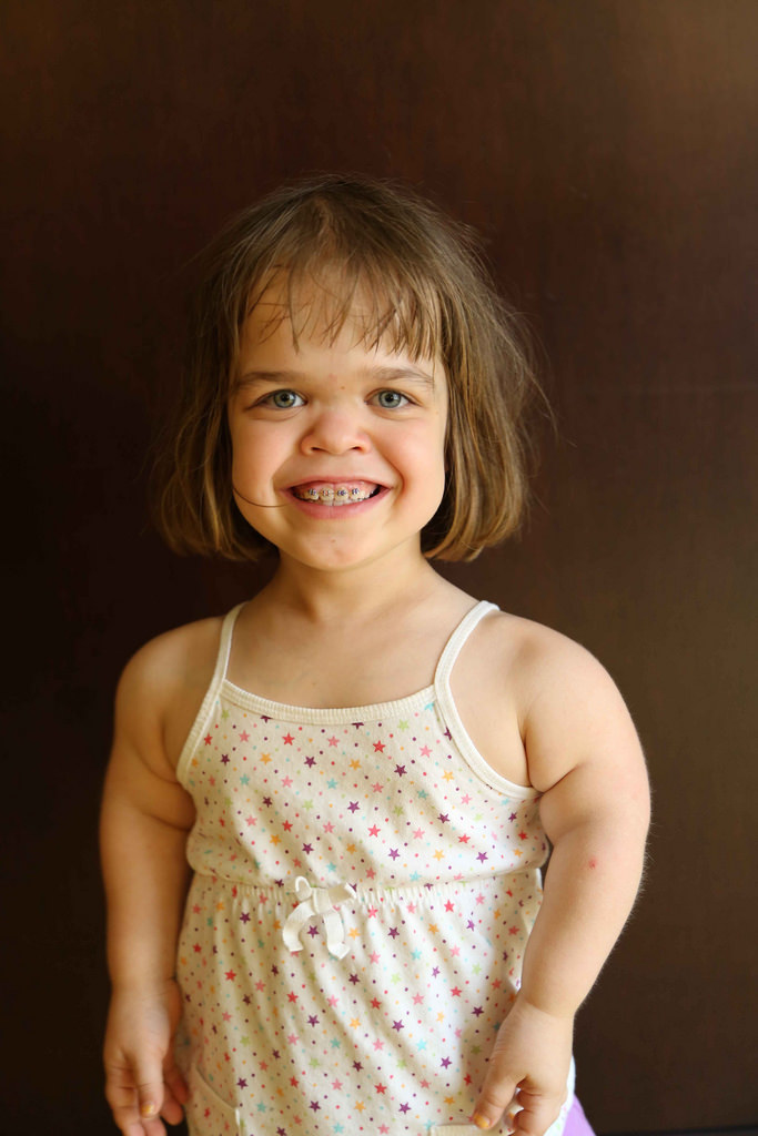 Positive Exposure Photo by Rick Guidotti