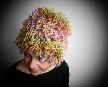 Ugly? Sure, but it still beats a comb-over.