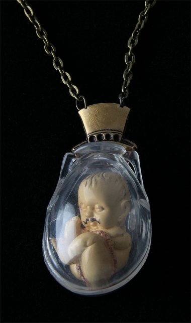 I know someone so hairy they claim to have had a mustache in the womb. Poor girl.