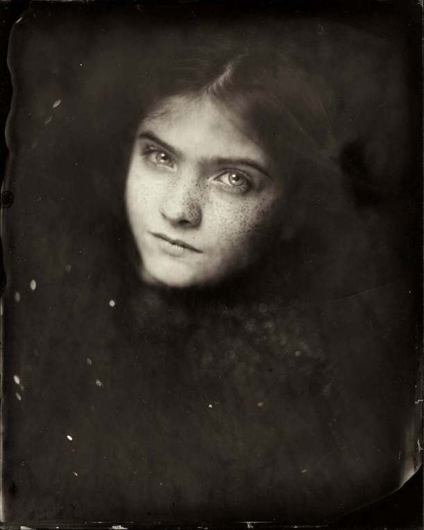 collodion