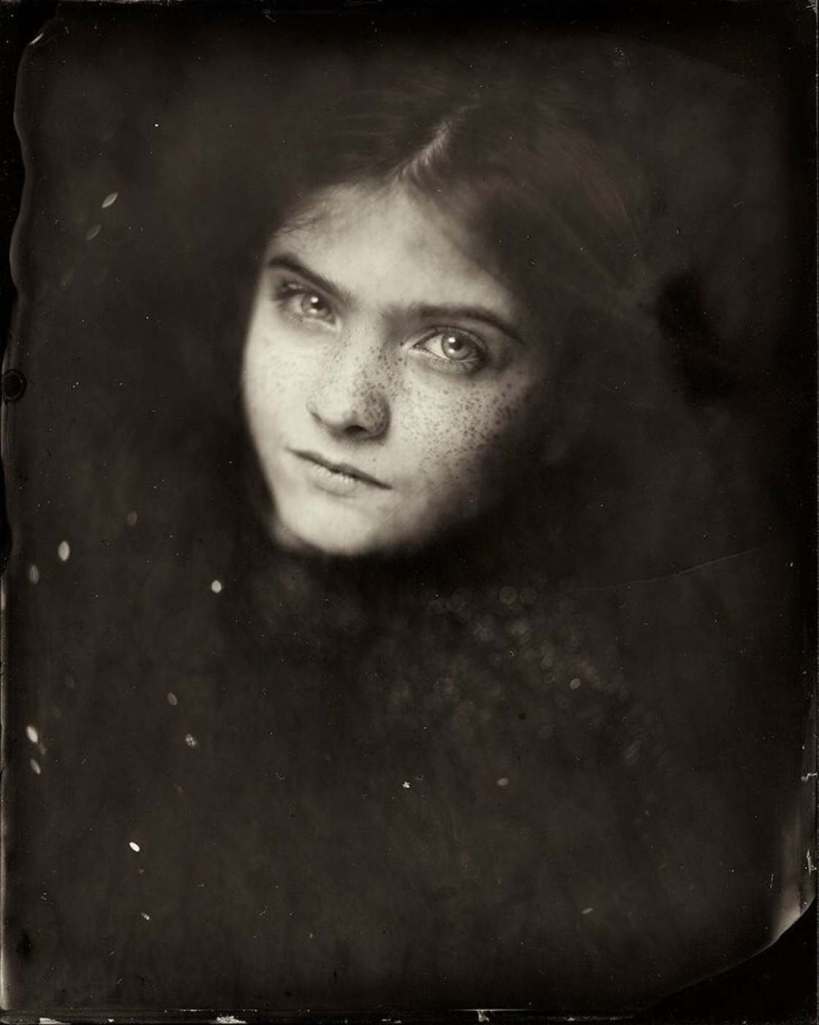 collodion